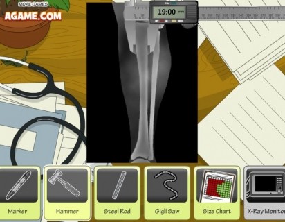 Click to play  Leg Surgery